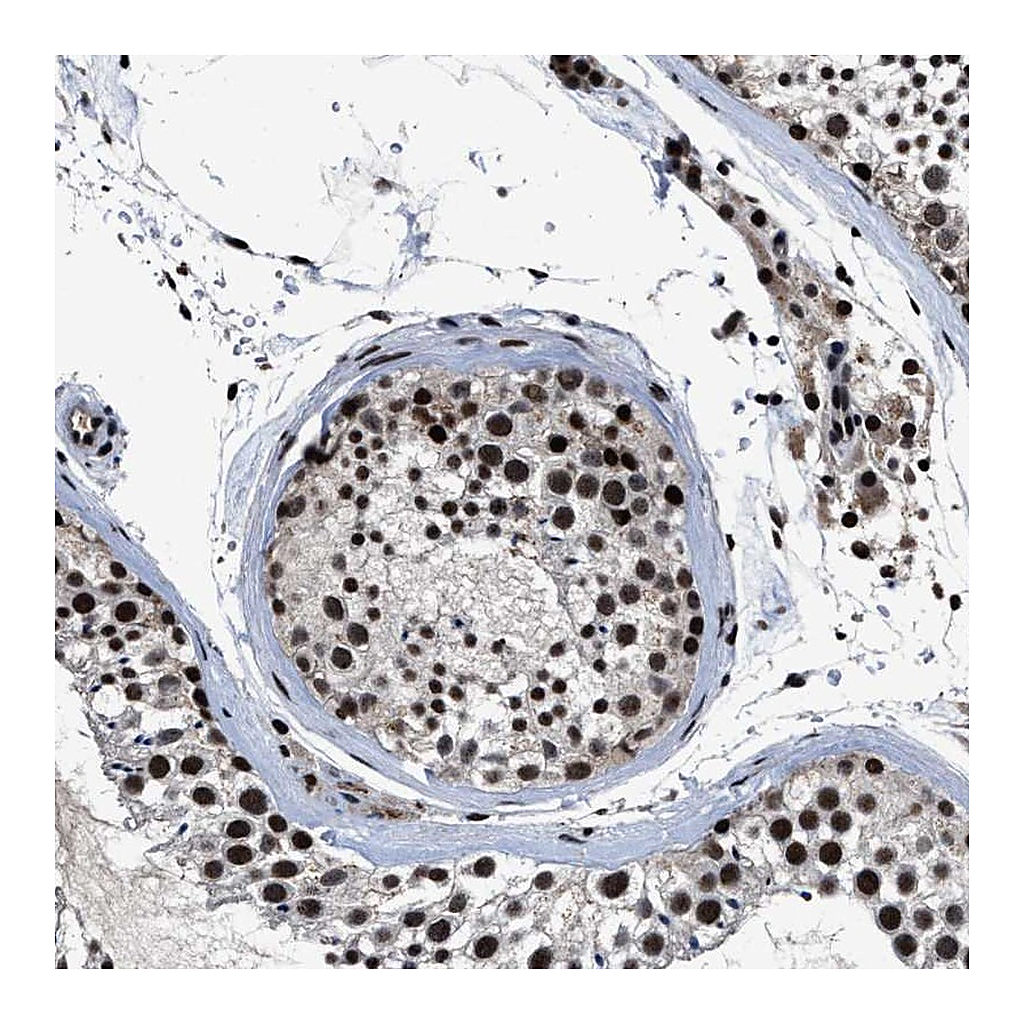 Atlas Antibodies Anti-ZNF233 Antibody