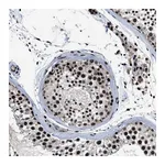 Atlas Antibodies Anti-ZNF233 Antibody