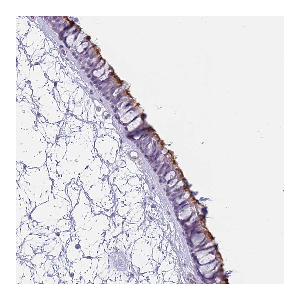 Atlas Antibodies Anti-ZNF239 Antibody