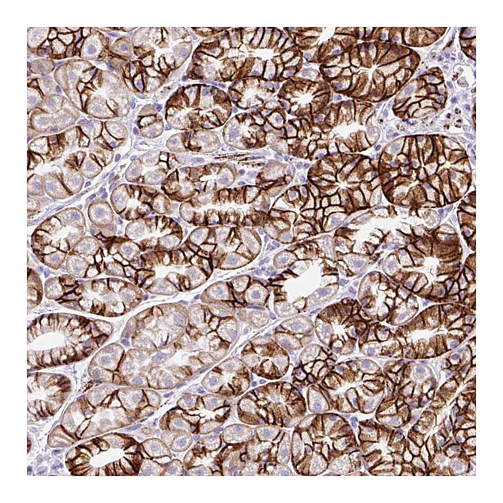 Atlas Antibodies Anti-ZNF256 Antibody