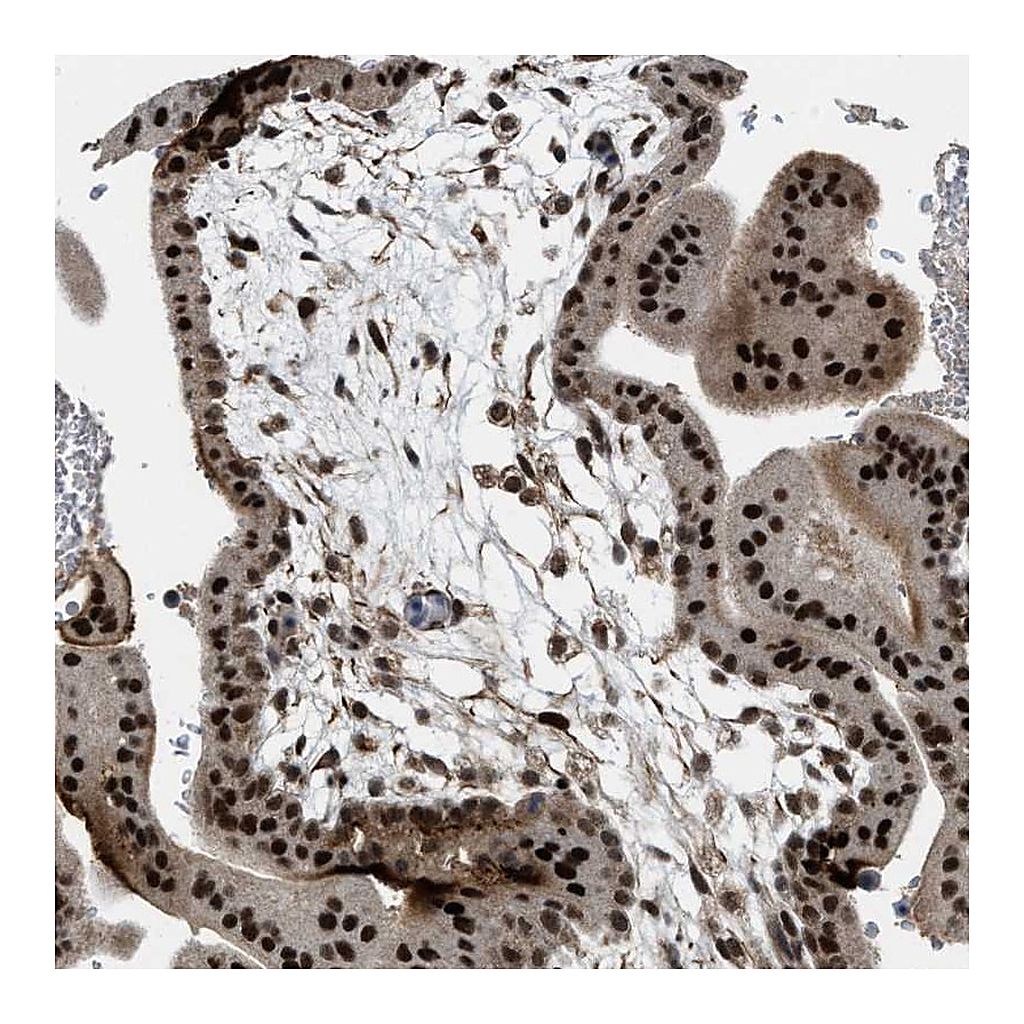 Atlas Antibodies Anti-ZNF250 Antibody