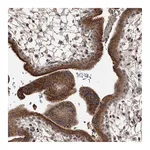 Atlas Antibodies Anti-ZNF25 Antibody
