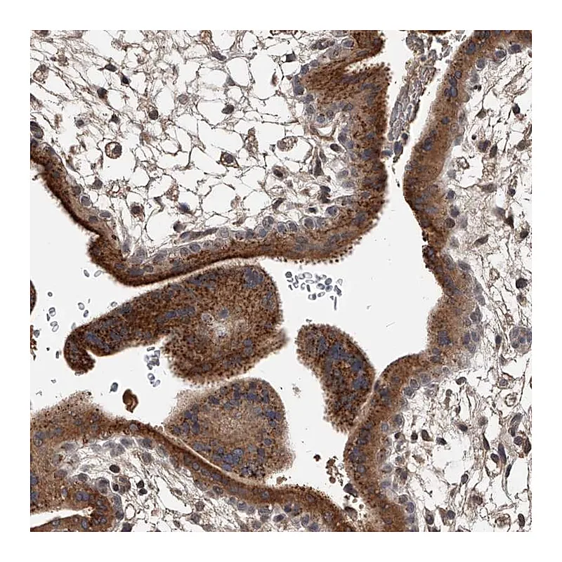 Atlas Antibodies Anti-ZNF25 Antibody