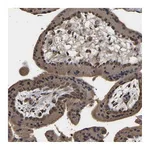 Atlas Antibodies Anti-ZNF26 Antibody