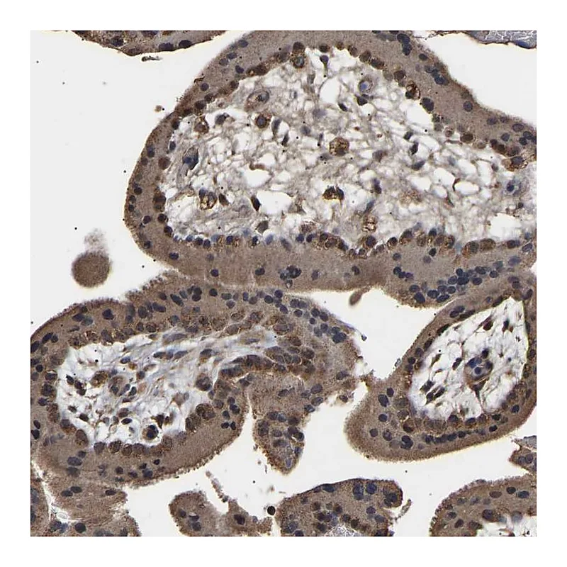 Atlas Antibodies Anti-ZNF26 Antibody