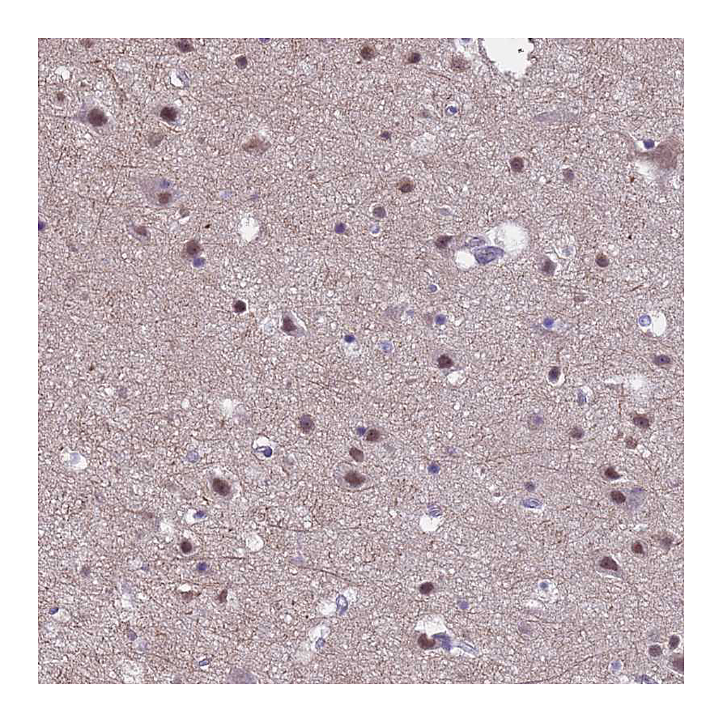 Atlas Antibodies Anti-ZNF248 Antibody