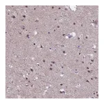 Atlas Antibodies Anti-ZNF248 Antibody