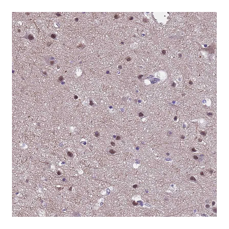 Atlas Antibodies Anti-ZNF248 Antibody
