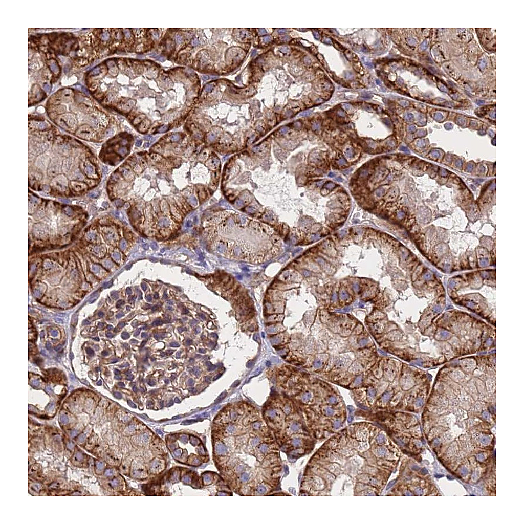 Atlas Antibodies Anti-ZNF248 Antibody
