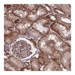 Atlas Antibodies Anti-ZNF248 Antibody