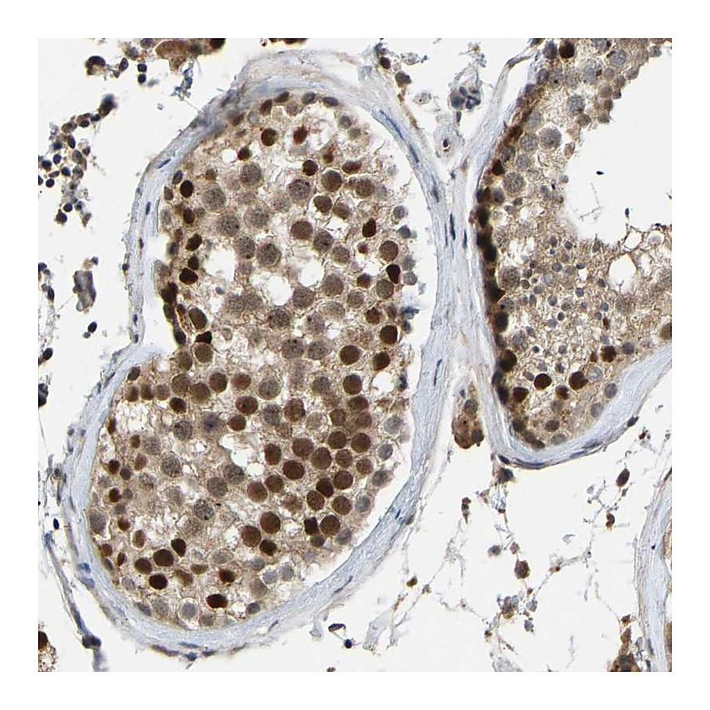 Atlas Antibodies Anti-ZNF251 Antibody