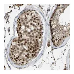 Atlas Antibodies Anti-ZNF251 Antibody