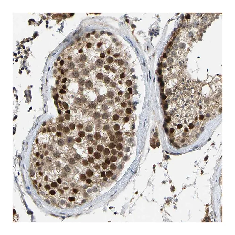Atlas Antibodies Anti-ZNF251 Antibody