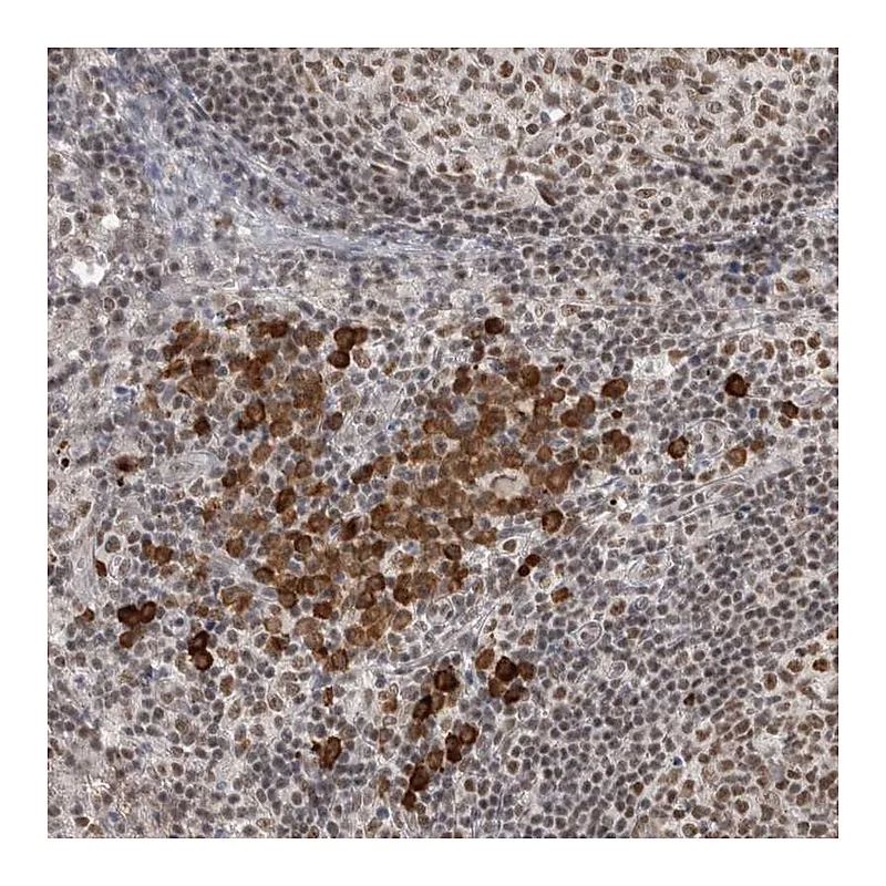Atlas Antibodies Anti-ZNF24 Antibody