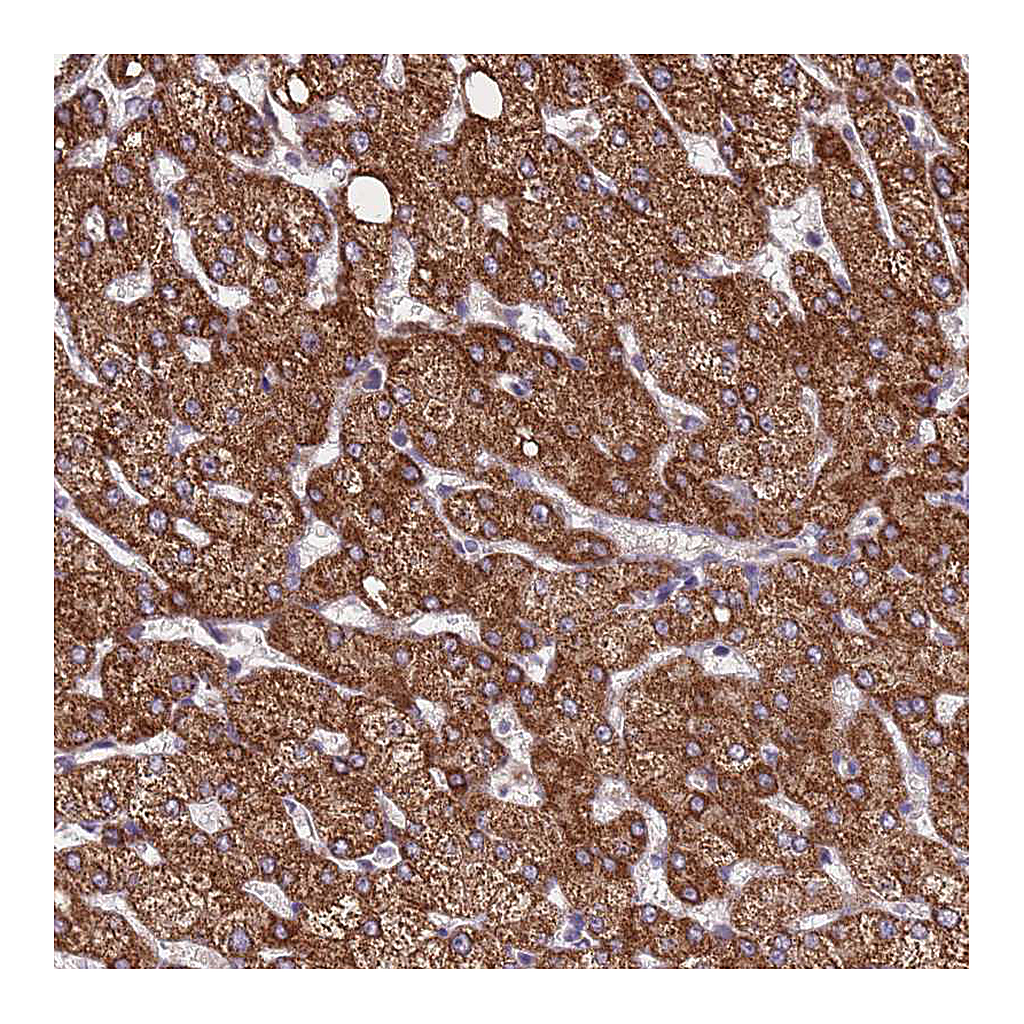 Atlas Antibodies Anti-ZNF248 Antibody