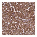 Atlas Antibodies Anti-ZNF248 Antibody