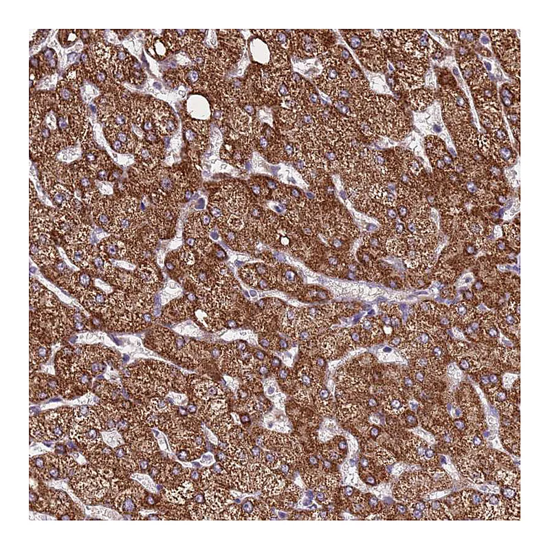 Atlas Antibodies Anti-ZNF248 Antibody
