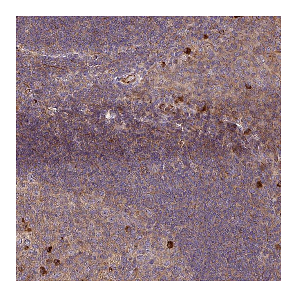 Atlas Antibodies Anti-ZNF266 Antibody
