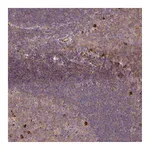 Atlas Antibodies Anti-ZNF266 Antibody