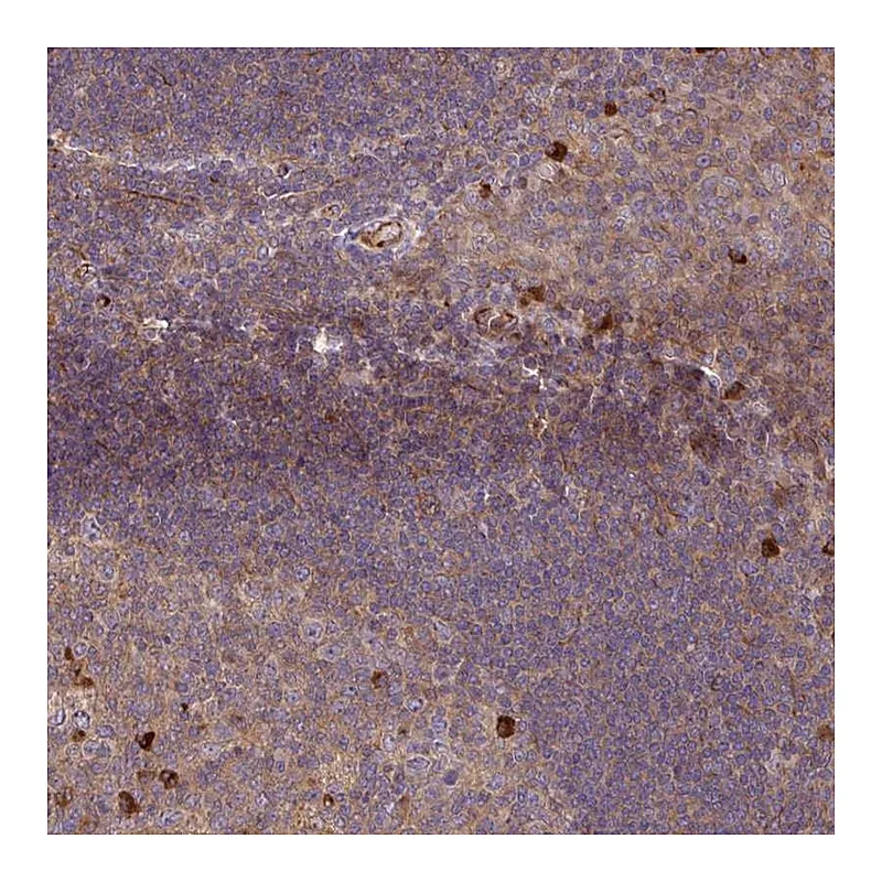 Atlas Antibodies Anti-ZNF266 Antibody