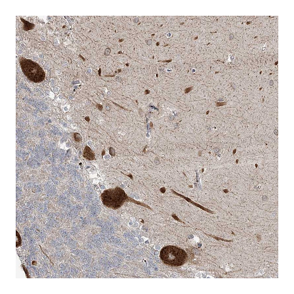 Atlas Antibodies Anti-ZNF263 Antibody