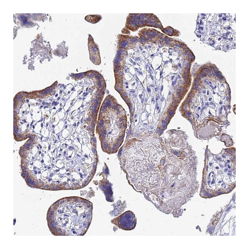 Atlas Antibodies Anti-ZNF26 Antibody