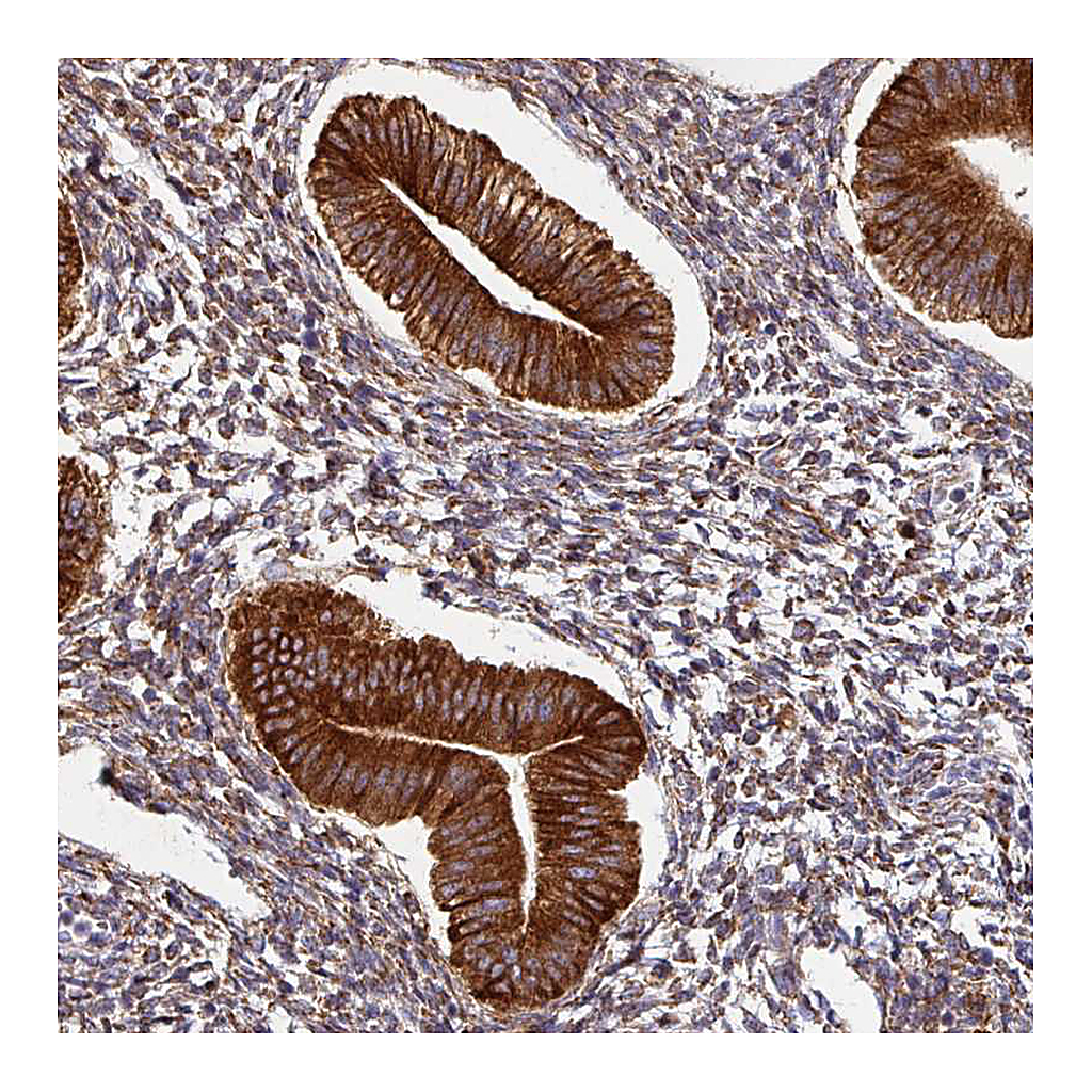 Atlas Antibodies Anti-ZNF268 Antibody