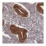 Atlas Antibodies Anti-ZNF268 Antibody
