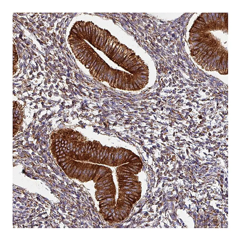 Atlas Antibodies Anti-ZNF268 Antibody