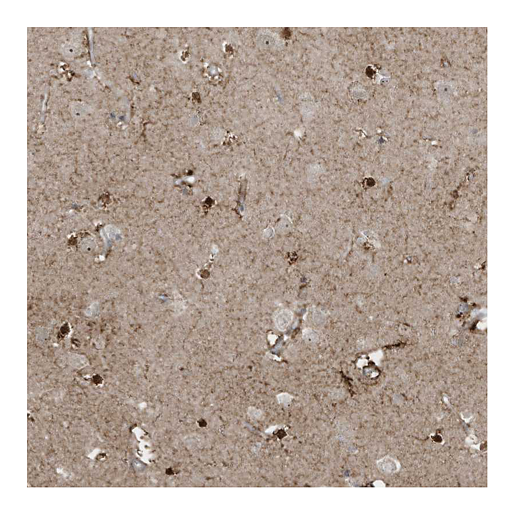 Atlas Antibodies Anti-ZNF263 Antibody