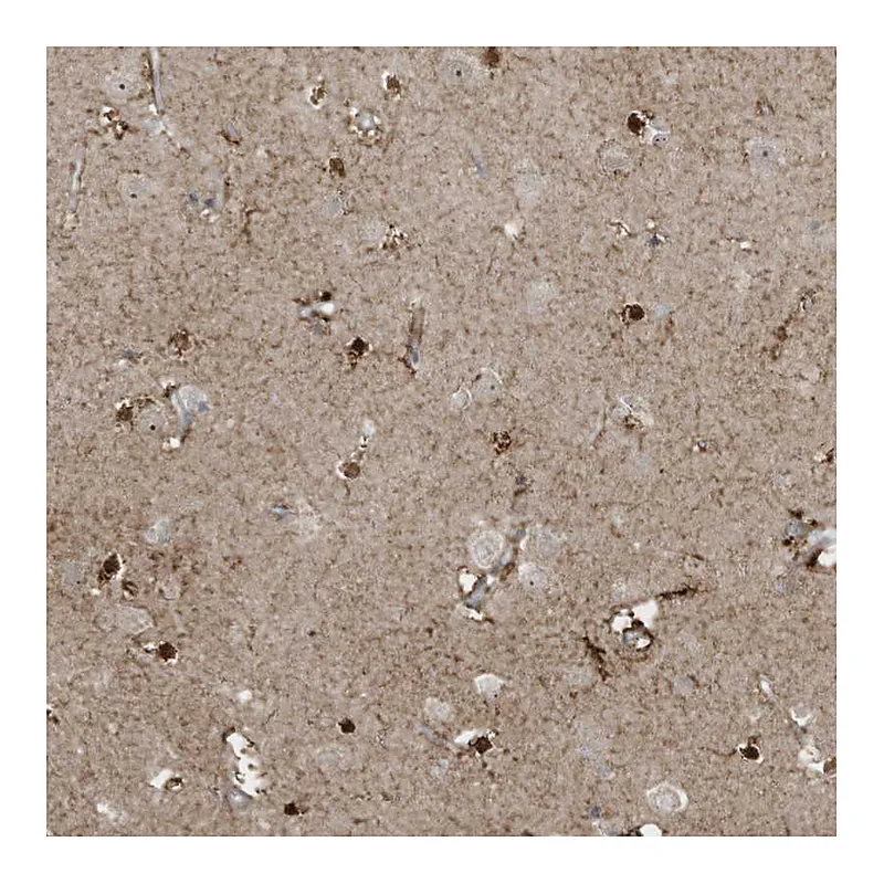 Atlas Antibodies Anti-ZNF263 Antibody