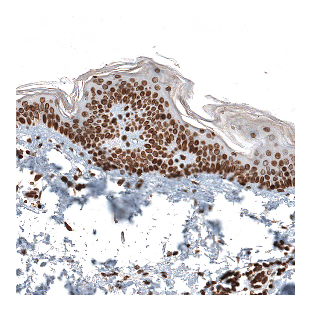 Atlas Antibodies Anti-ZNF266 Antibody