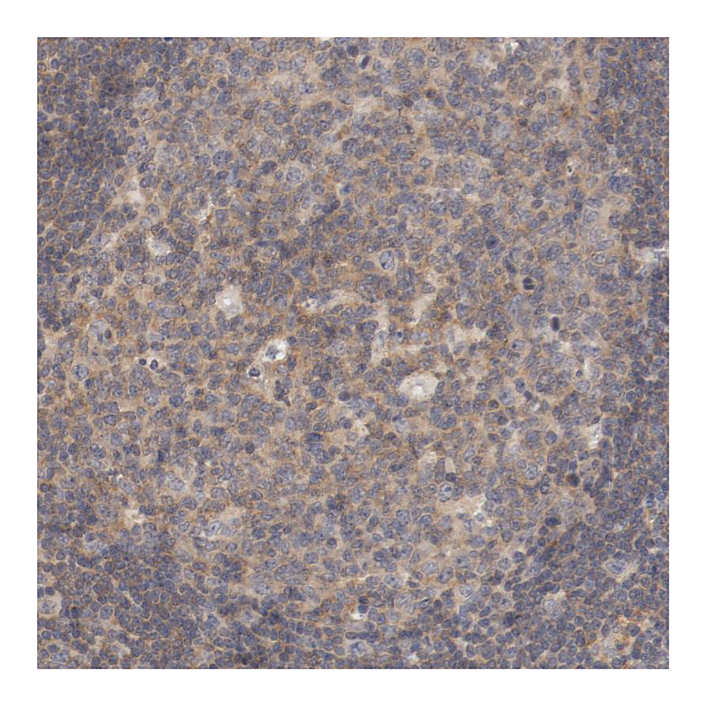 Atlas Antibodies Anti-ZNF267 Antibody