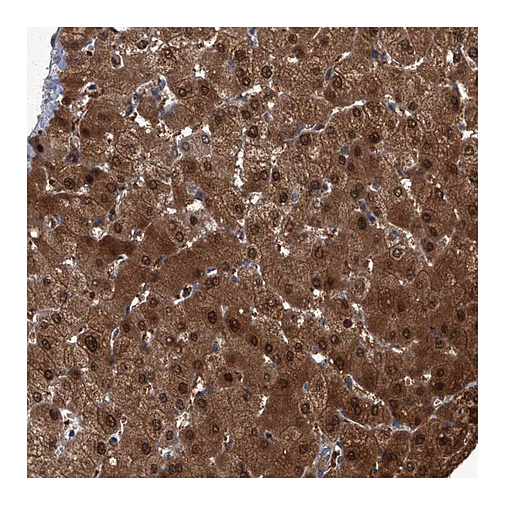 Atlas Antibodies Anti-ZNF274 Antibody