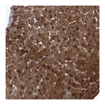 Atlas Antibodies Anti-ZNF274 Antibody