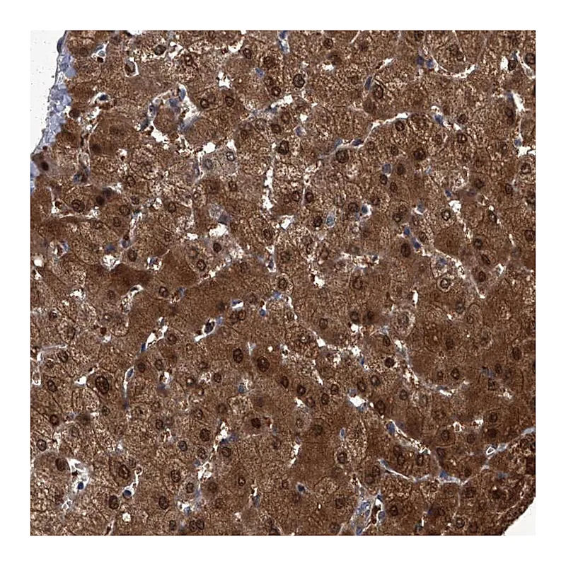 Atlas Antibodies Anti-ZNF274 Antibody