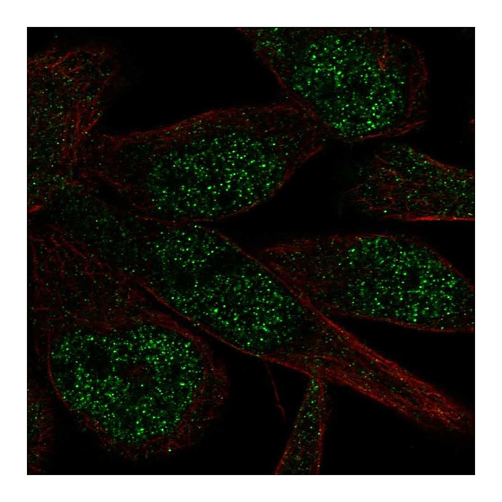 Atlas Antibodies Anti-ZNF273 Antibody