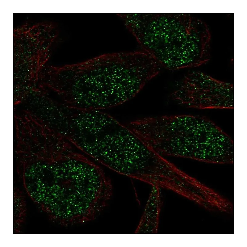 Atlas Antibodies Anti-ZNF273 Antibody