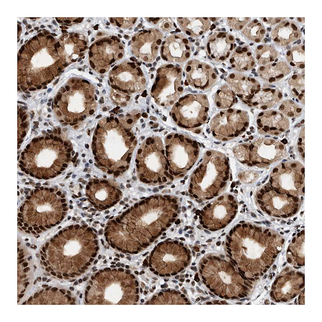 Atlas Antibodies Anti-ZNF260 Antibody