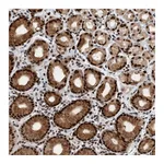 Atlas Antibodies Anti-ZNF260 Antibody