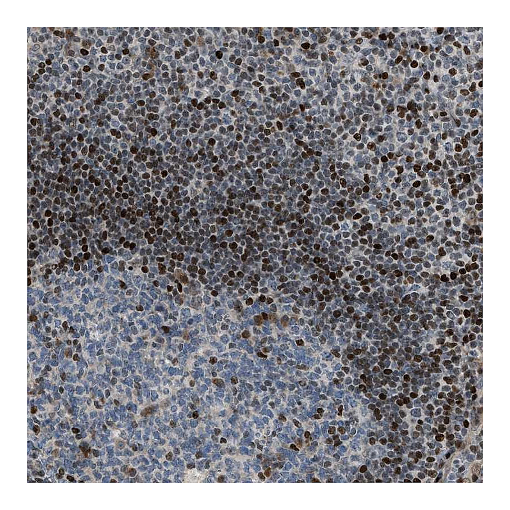 Atlas Antibodies Anti-ZNF276 Antibody