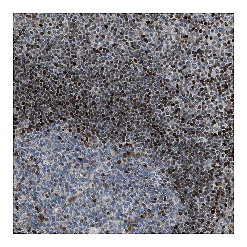 Atlas Antibodies Anti-ZNF276 Antibody