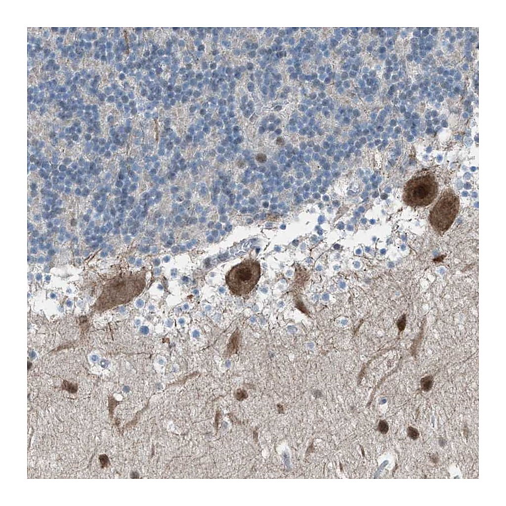 Atlas Antibodies Anti-ZNF276 Antibody