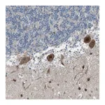 Atlas Antibodies Anti-ZNF276 Antibody