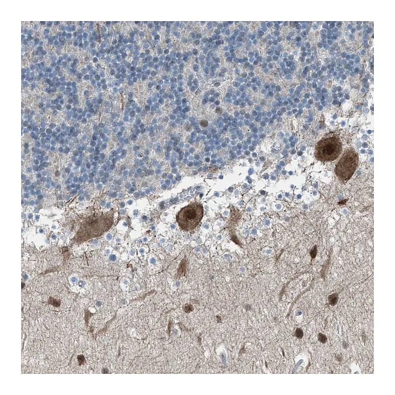 Atlas Antibodies Anti-ZNF276 Antibody
