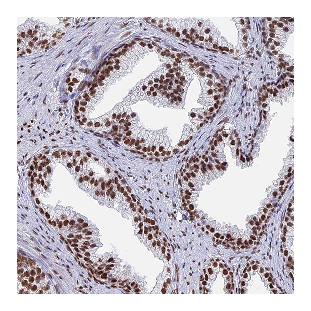 Atlas Antibodies Anti-ZNF280A Antibody