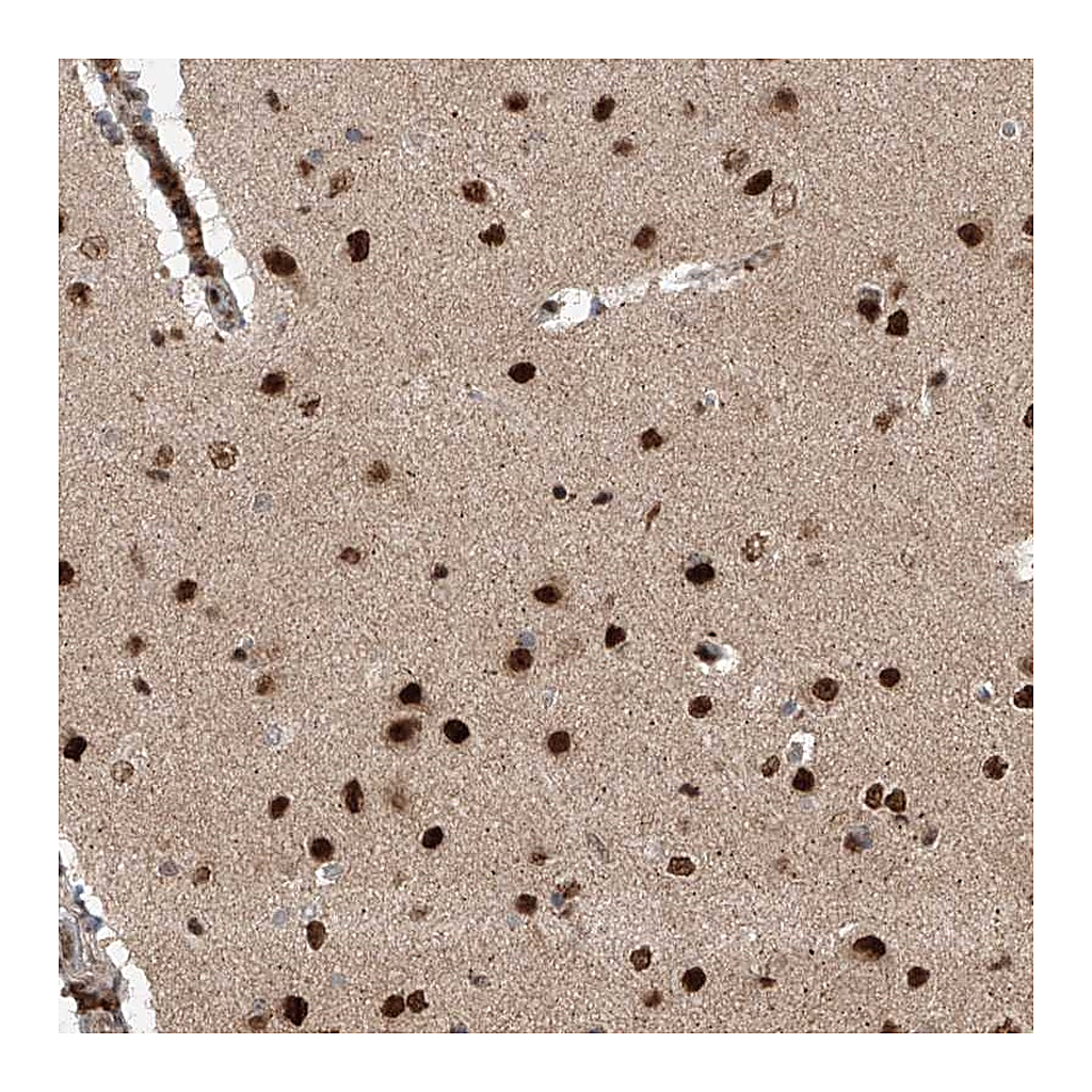 Atlas Antibodies Anti-ZNF280D Antibody