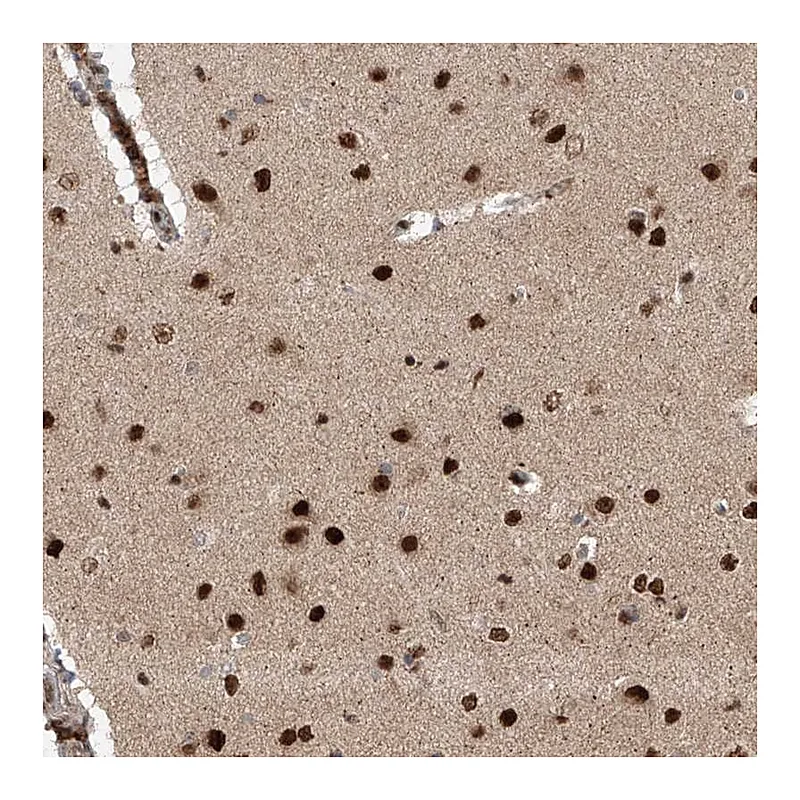 Atlas Antibodies Anti-ZNF280D Antibody