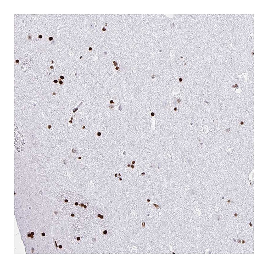 Atlas Antibodies Anti-ZNF280C Antibody