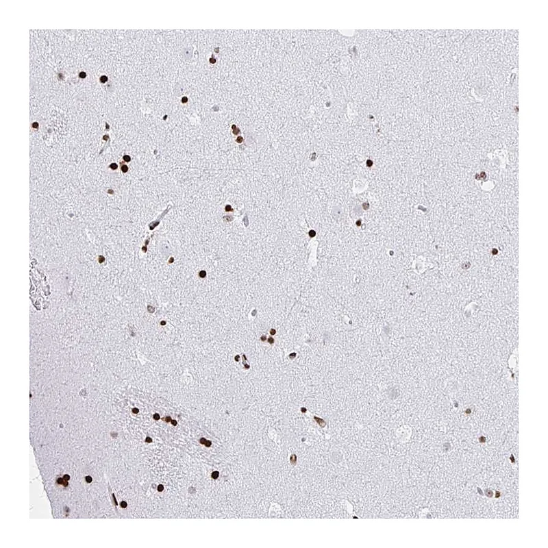 Atlas Antibodies Anti-ZNF280C Antibody